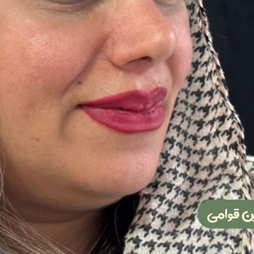 بعد از سانترال لب
