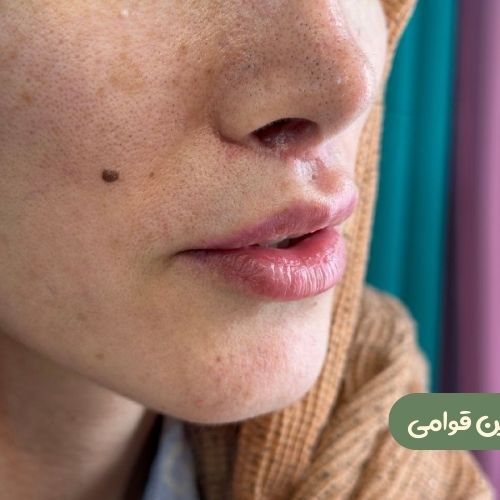 بعد از سانترال لب