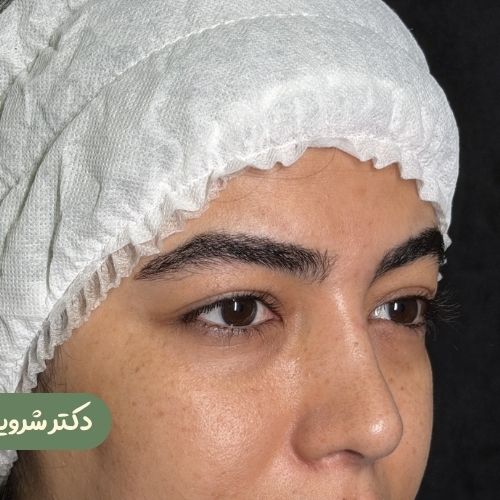 قبل از دایرکت ابرو