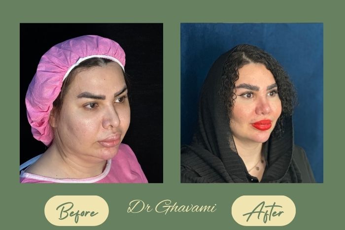 بوکال فت بوکال فت