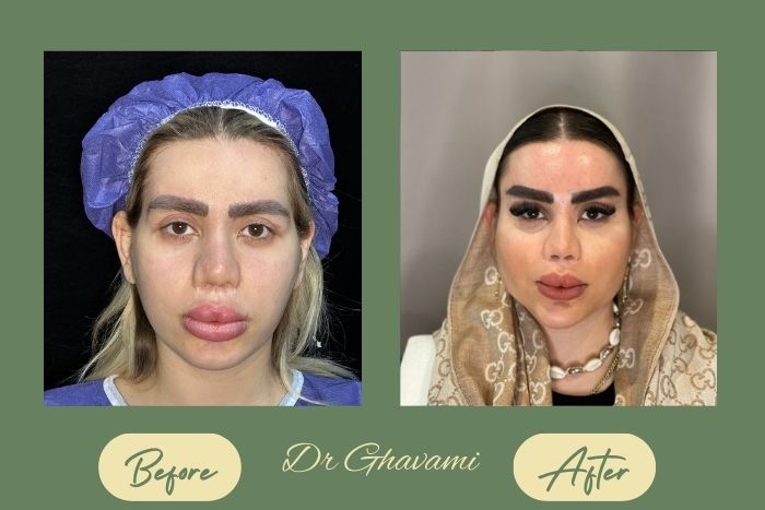 بوکال فت بوکال فت