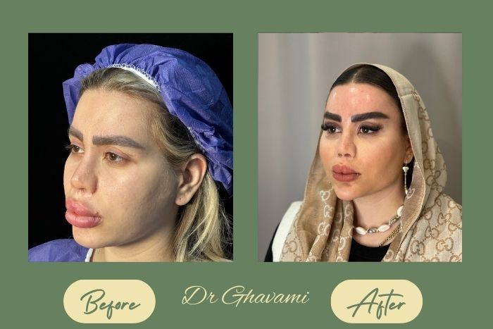 بوکال فت بوکال فت