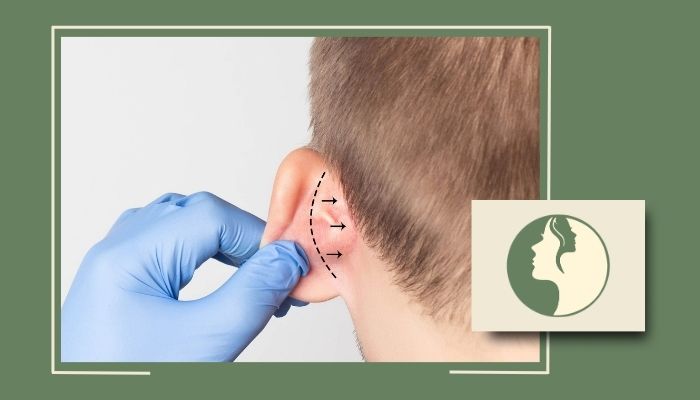 آیا اتوپلاستی روی شنوایی تاثیر دارد؟ بررسی مهمترین نکات آیا اتوپلاستی روی شنوایی تاثیر دارد؟ بررسی مهمترین نکات