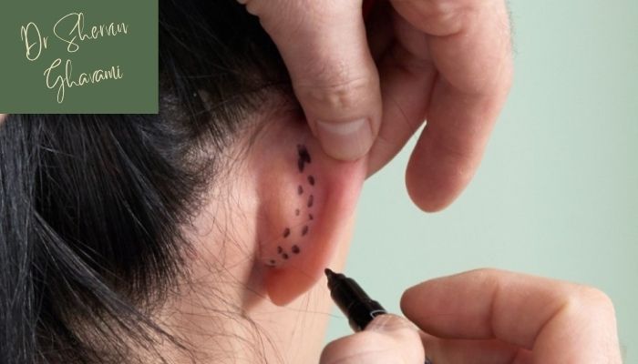 آیا امکان جراحی فقط روی یک گوش وجود دارد؟ آیا امکان جراحی فقط روی یک گوش وجود دارد؟