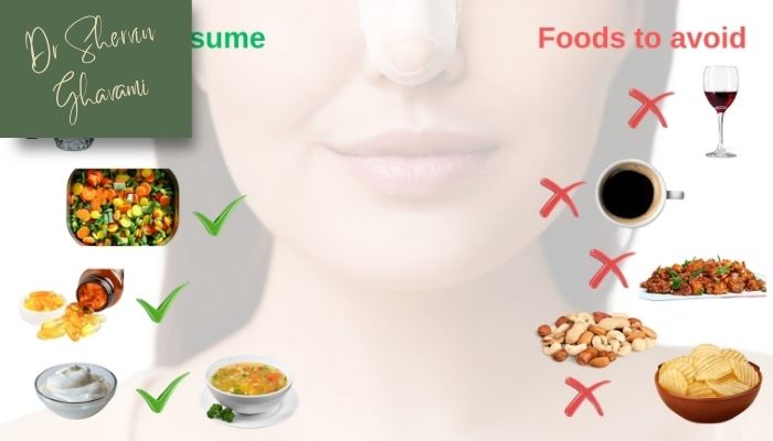 بعد از عمل بینی چه غذاهایی بخوریم و از چه غذاهایی پرهیز کنیم؟