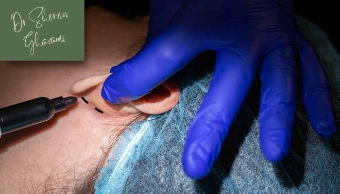 دلایل رایج جراحی زیبایی گوش