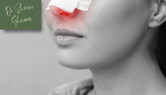 دلایل مشکل تنفسی پس از جراحی بینی