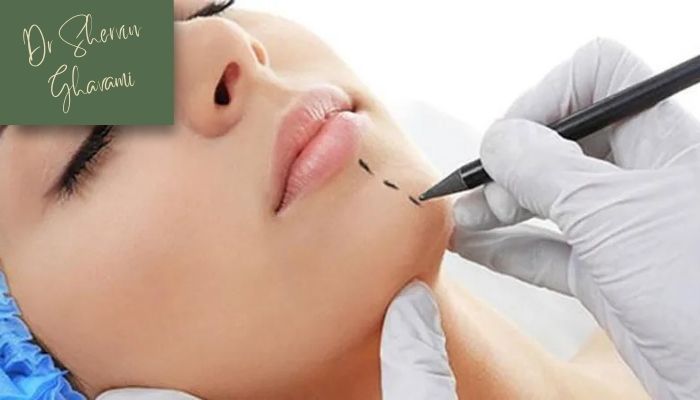 نتیجه نهایی پروتز چانه و گونه