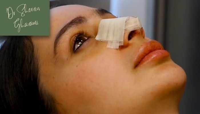 علت های اصلی بوی نامطبوع بینی