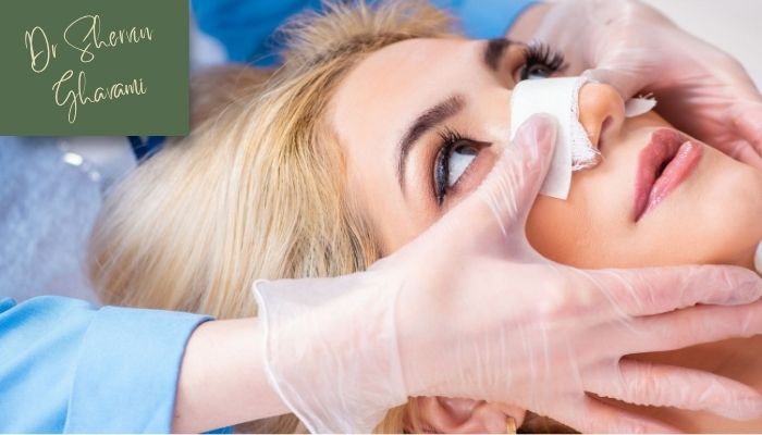 عوارض رعایت نکردن رژیم غذایی بعد از عمل بینی