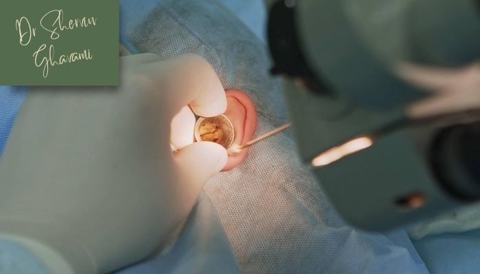 مراقبت‌های بعد از اتوپلاستی  