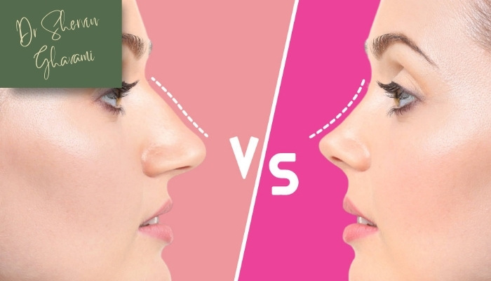 مقایسه جراحی بینی طبیعی و فانتزی