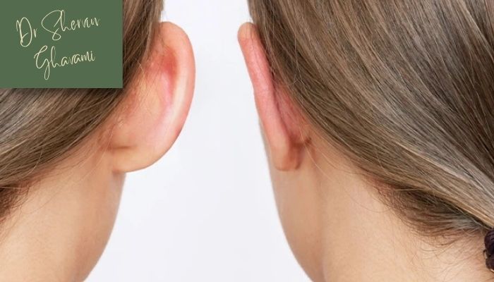 نقش تکنیک‌های اتوپلاستی در اصلاح گوش