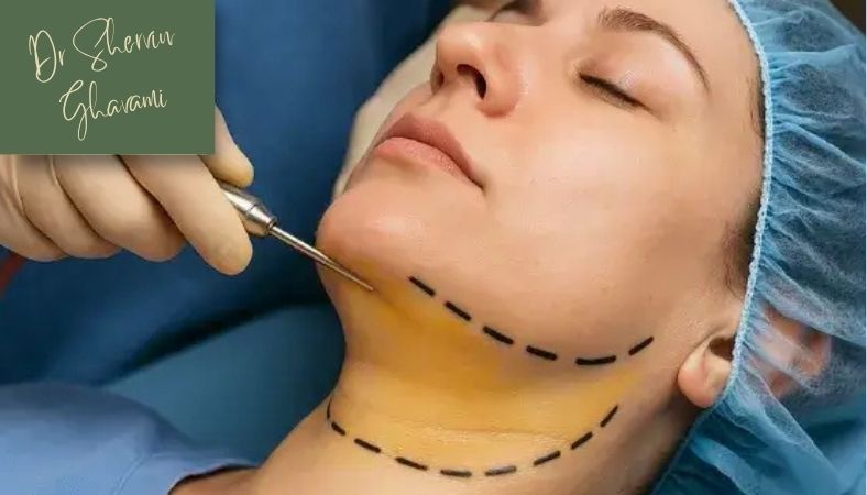 چه زمانی سفتی غبغب بعد از ساکشن خطرناک است؟ چه زمانی سفتی غبغب بعد از ساکشن خطرناک است؟